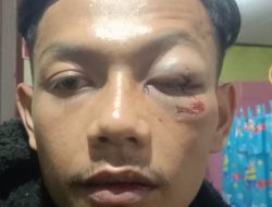 “Robi Gunawan Menjadi Korban Penganiayaan Brutal, Pelaku Harus Secepatnya Diproses Hukum ?!”