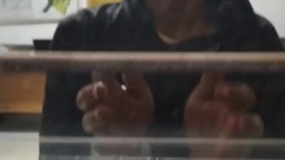 Diduga Salah Tangkap, Seorang Pria Dianiaya Oknum Security PTPN IV Kebun Tandun Hingga Alami Luka di Kepala