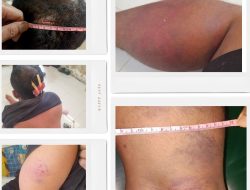 Penganiayaan Dan Pengeroyokan Terhadap Anasrul Oleh Security dan Centeng PT Tasma Puja