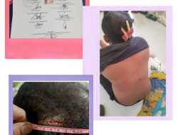 Pihak Anasrul Korban Penganiayaan Dan Pengeroyokan Tidak Terima Atas Hasil Kesepakatan Pertemuan Pihak PT Tasma Puja Dengan Masyarakat Desa Sungai Tarap kec. Kampa